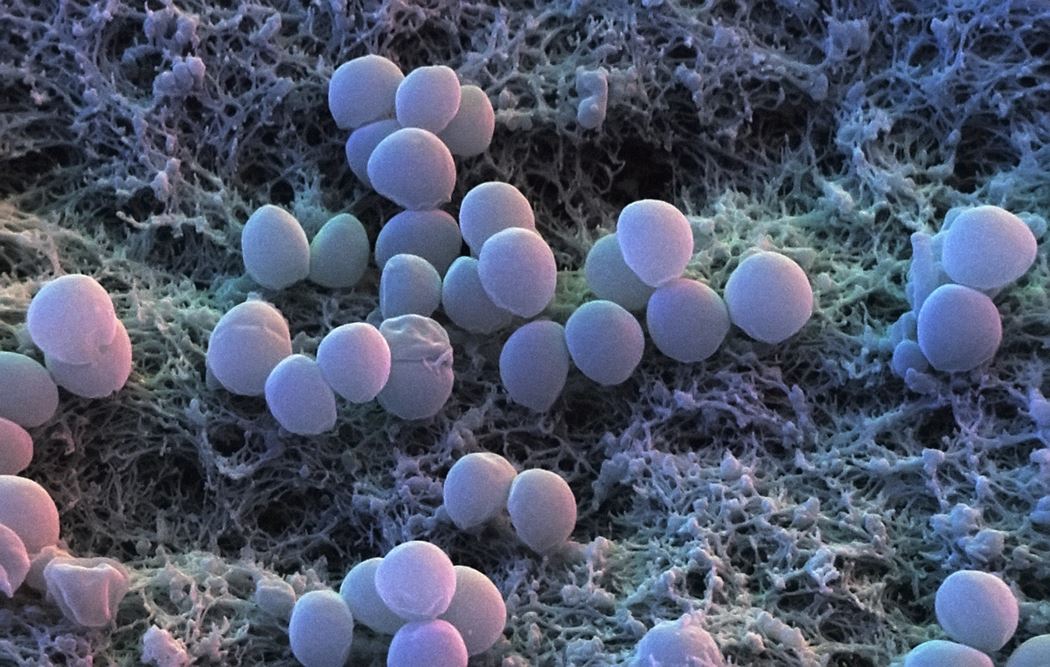 Staphylococcus aureus золотистый стафилококк